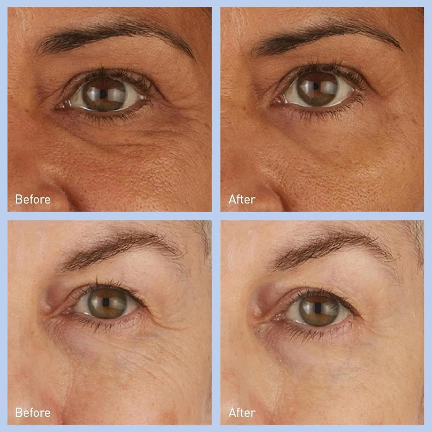 Hydro Cool Firming under Eye Patches. Eye Gel Mask to Firm and Reduce Wrinkles, Fine Lines, Dark Circles, Puffy Eyes & Bags, 4 Pairs